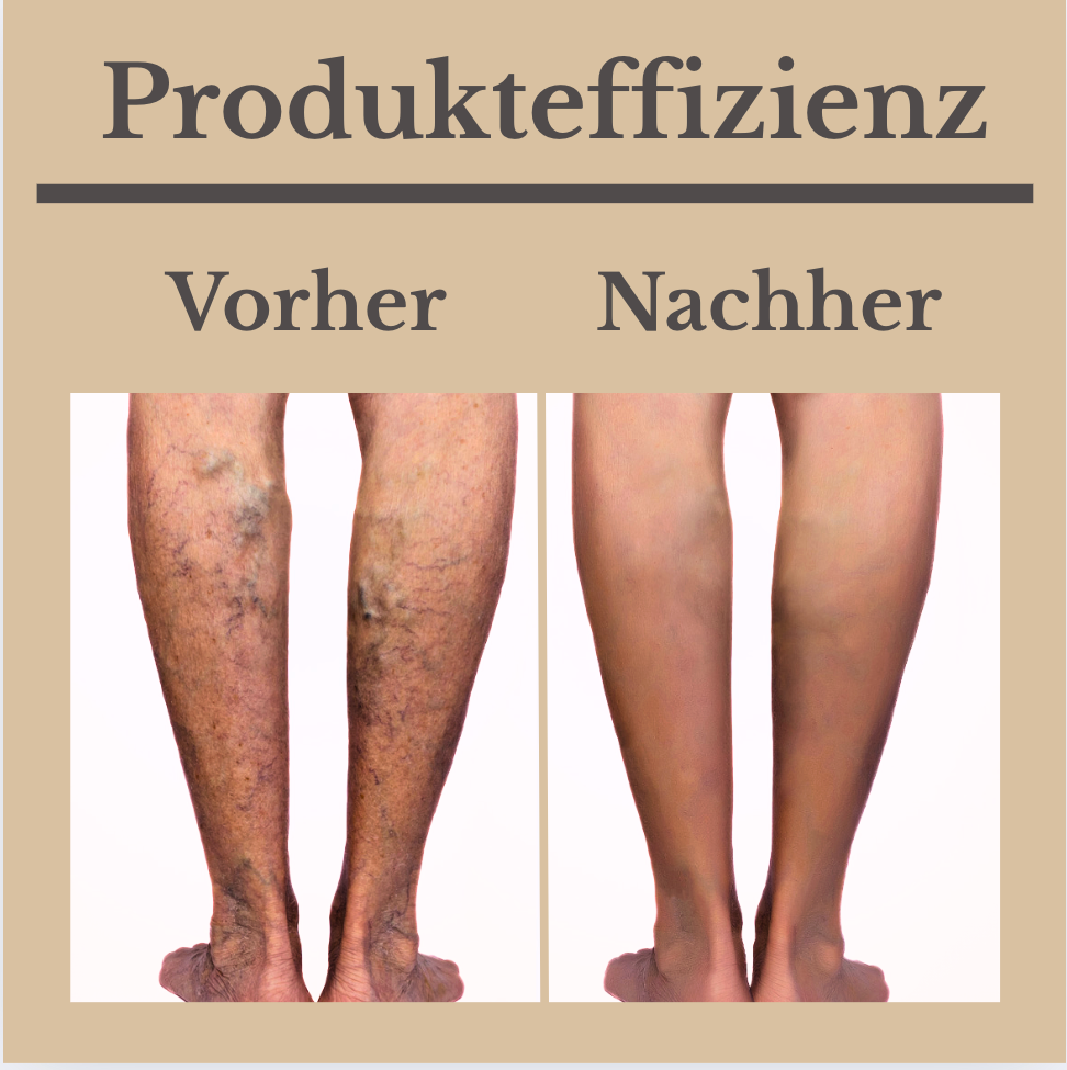 Venen-vital pro Creme