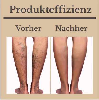 Venen-vital pro Creme